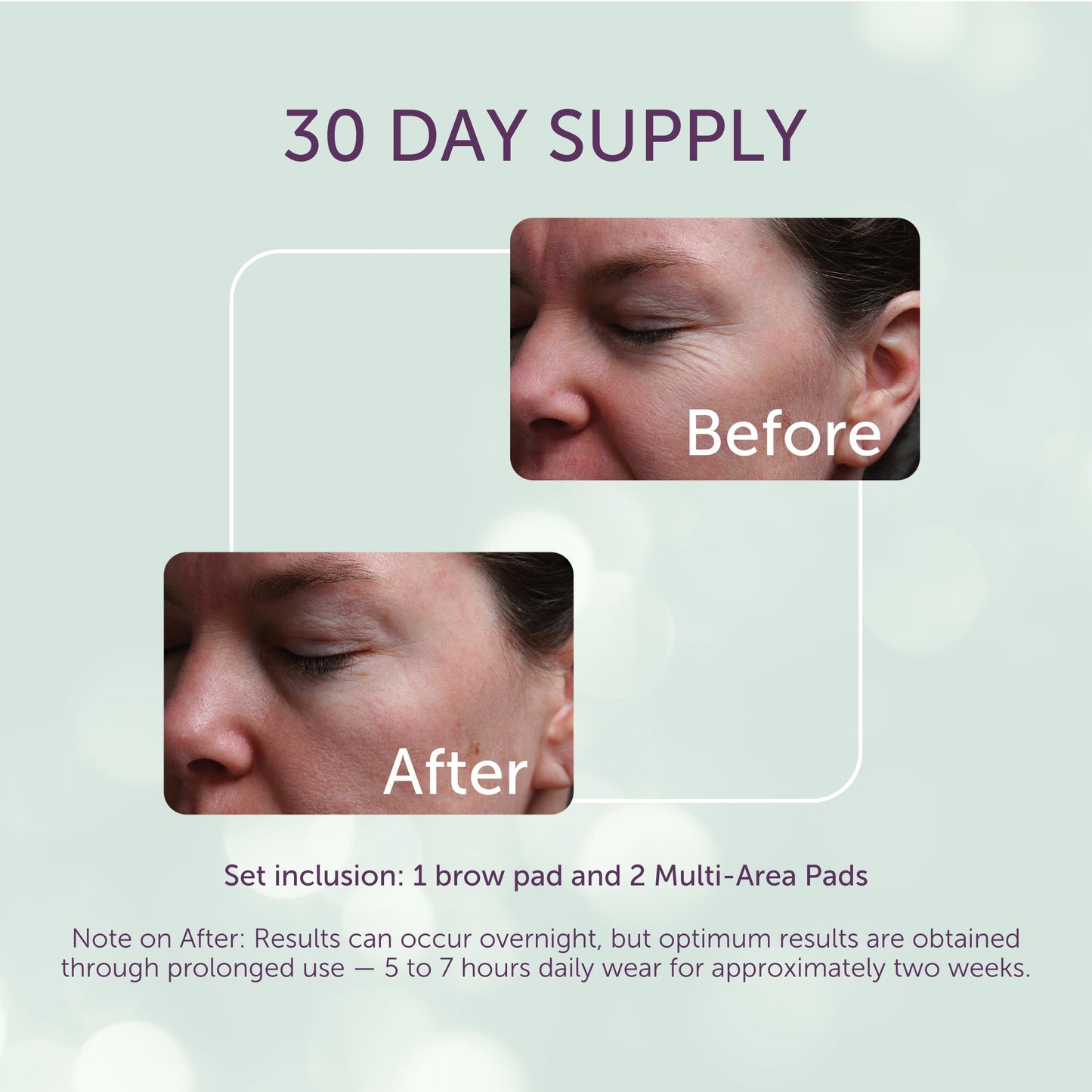 Silcskin Facial And Brow Pads Set Reusable Silicone Pads For Forehead And Facial Areas, 30 Day Supply, Stocking Stuffer Wrinkle Care Gift For Women