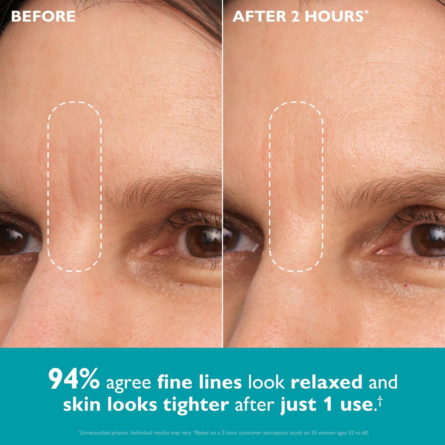 Peter Thomas Roth | Peptide Skinjection™ Peptide-Infused Face & Eye Tape | Face Tape For Wrinkles and Aging Skin | Peptide Face Tape Beauty and Personal Care Peter Thomas Roth