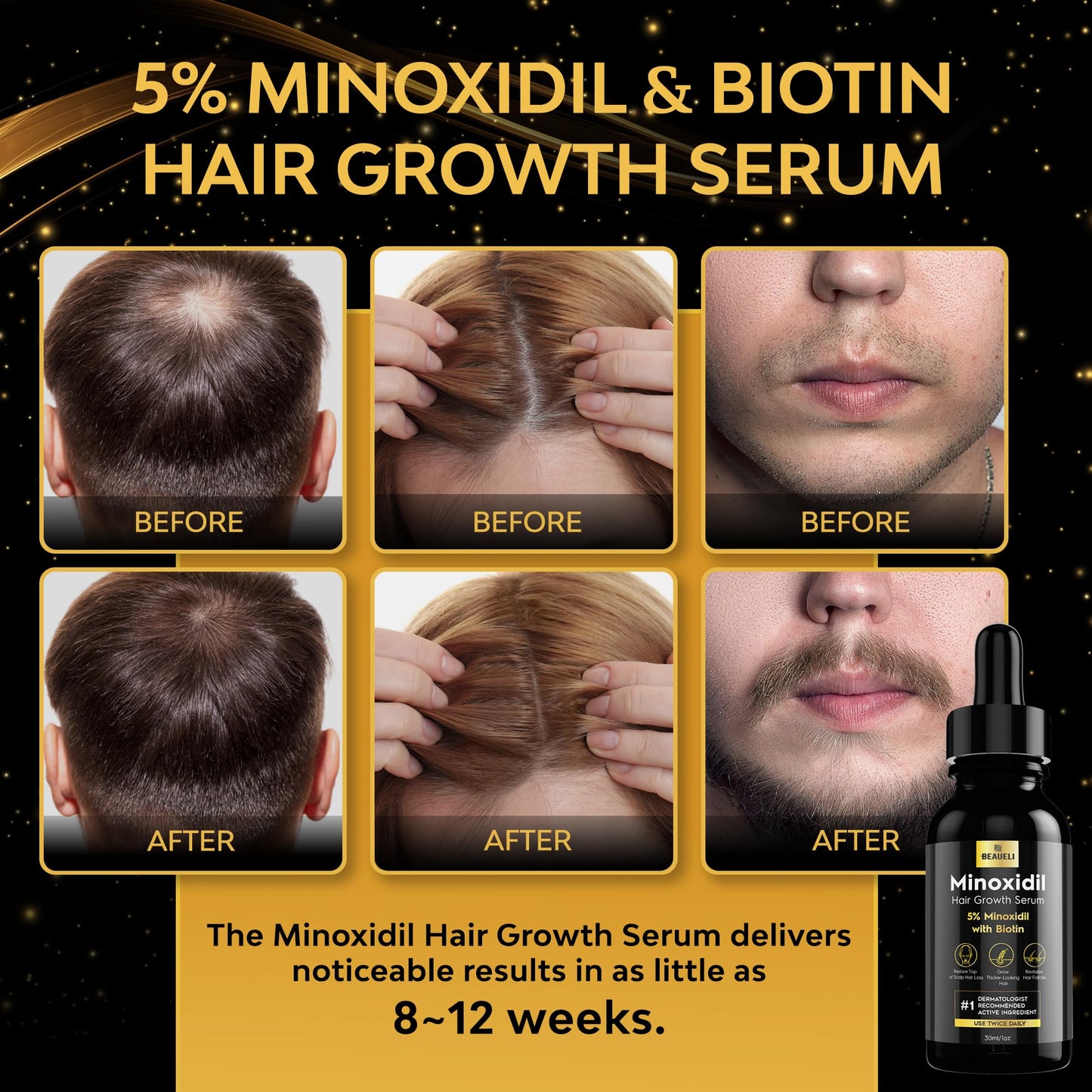 Beaueli 5% Minoxidil for Men and Women, Hair Growth, Beard Growth, Hair Regrowth, Unscented Drop, 3 Fl Oz, 3 Bottles Beauty and Personal Care beaueli