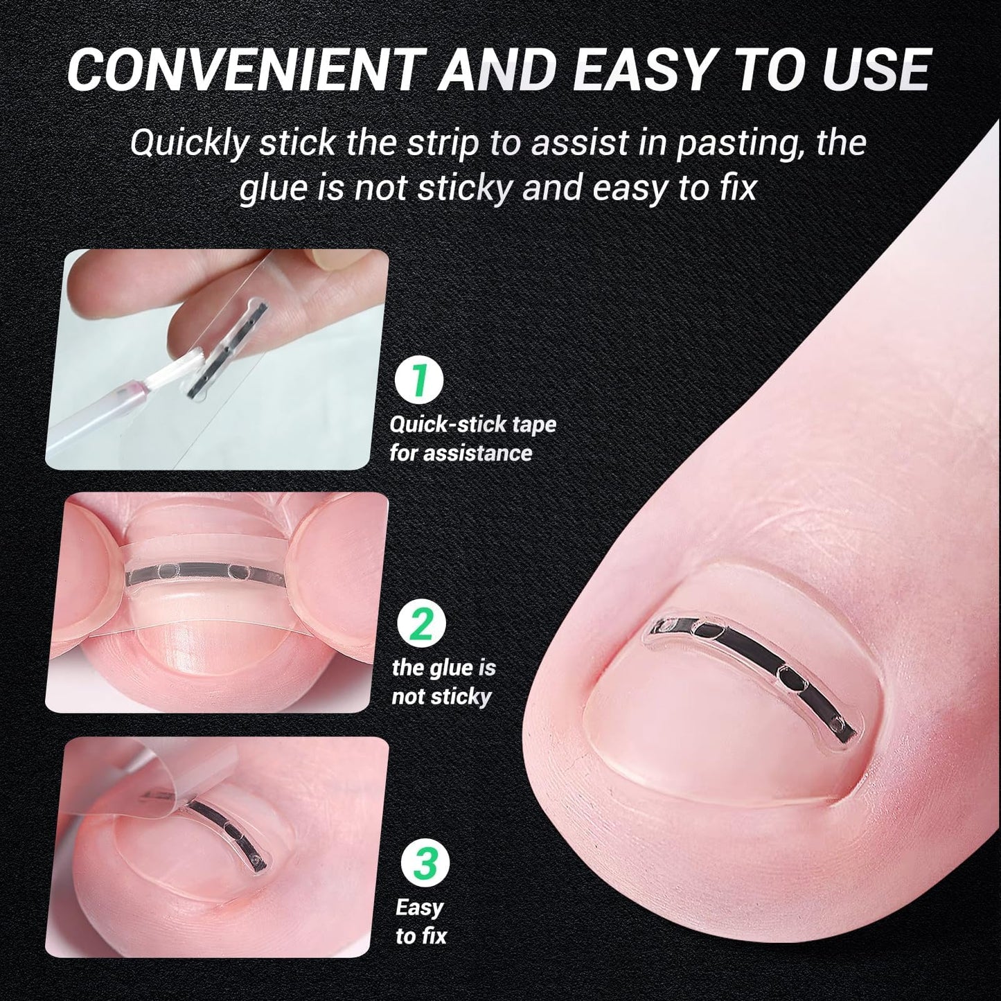 Reieset Titanium Alloy Ingrown Toenail Treatment, Nail Tools, and Ingrown Toenail Removal Kit Specially Designed for Curved Nail Repair and Ingrown Beauty and Personal Care Reieset