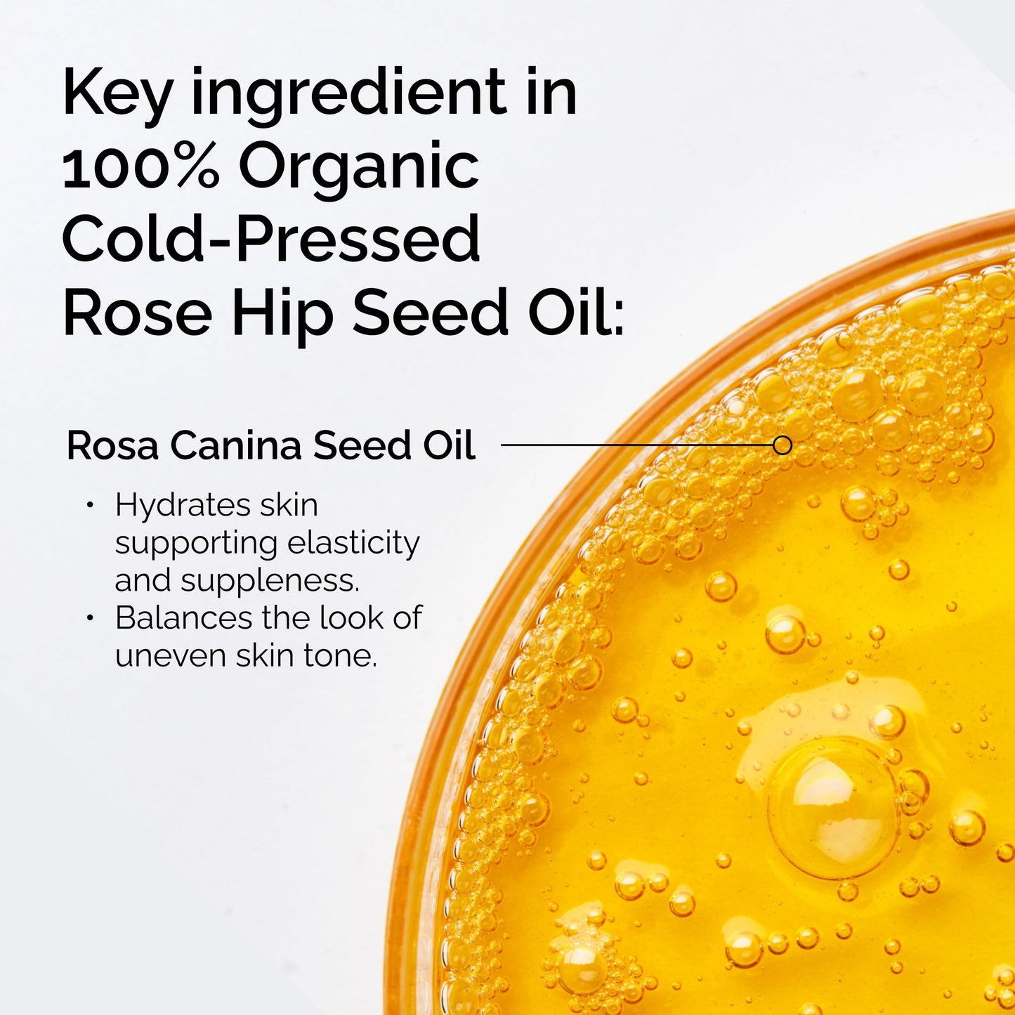 The Ordinary 100% Organic Cold-Pressed Rose Hip Seed Oil, Addresses Signs of Aging by Improving the Appearance of Uneven Skin Tone, Supporting Skin
