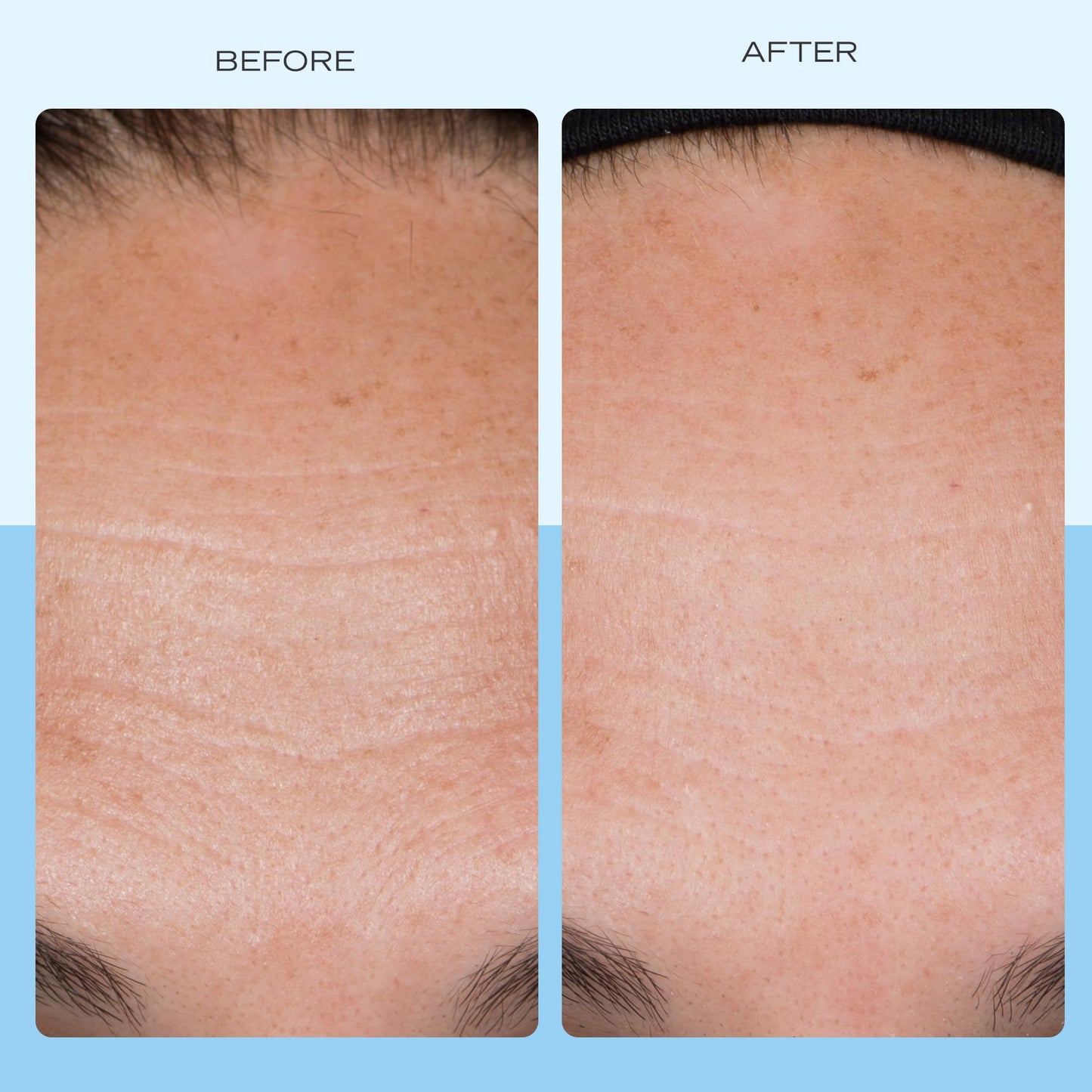 First Aid Beauty Firming Collagen Cream with Collagen, Peptides and Niacinamide - Day + Night Anti-Aging Face Moisturizer - 1.7 fl oz