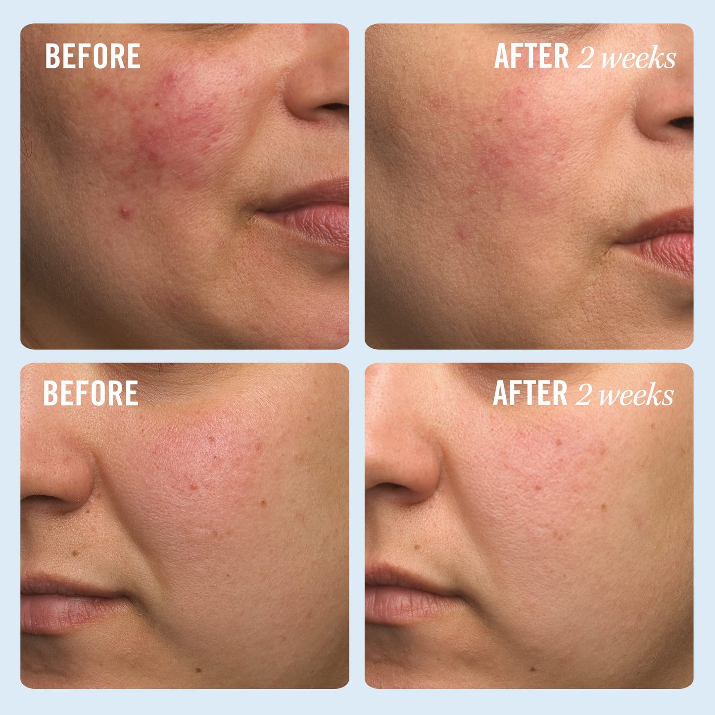 First Aid Beauty Ultra Repair Cream Intense Hydration Moisturizer for Face and Body - 1 oz