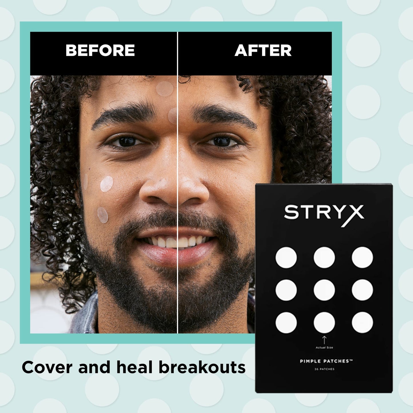 Stryx Hydrocolloid Acne Pimple Patches for Men, 3-Pack - Great for Breakouts, Zits, Blemishes, Whiteheads, & Reducing Redness - Designed for Men’s
