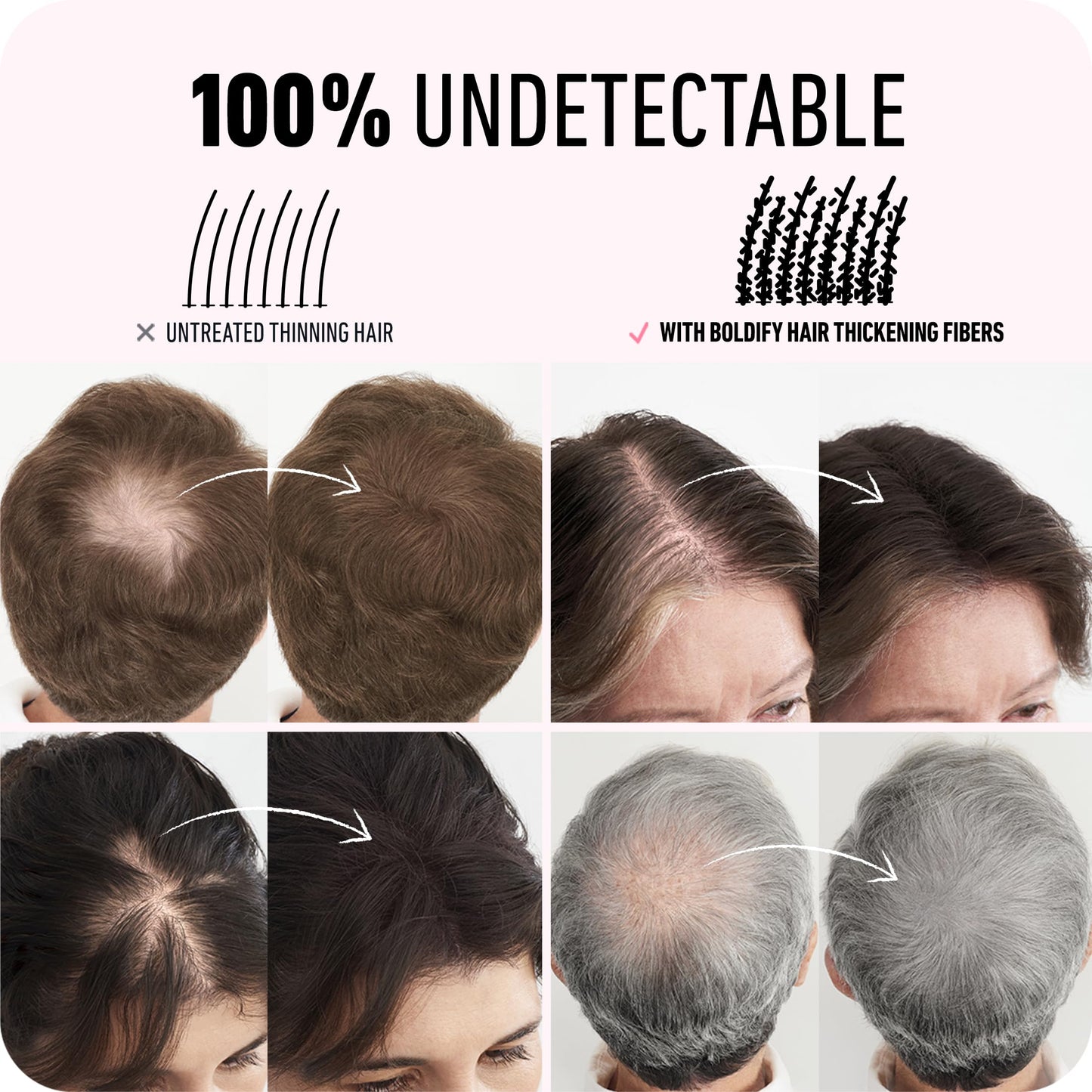 BOLDIFY Hair Fibers - Fill In Thinning and Fine Hair for an Instantly Fuller, Thicker Look - 14 Shades for Women & Men Beauty and Personal Care Boldify