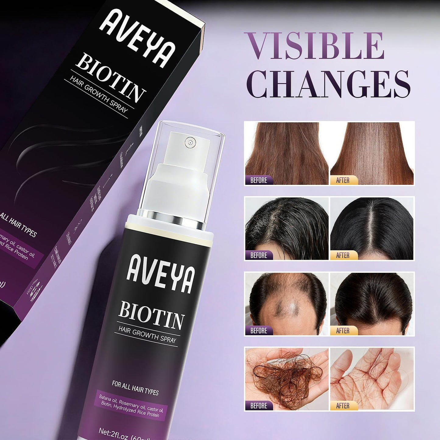 AVEYA Hair Growth Spray, infused with Rosemary Oil,rice water,Batana Oil&Biotin for Scalp - Strengthens,Thickens&Accelerates Hair Care Beauty and Personal Care AVEYA