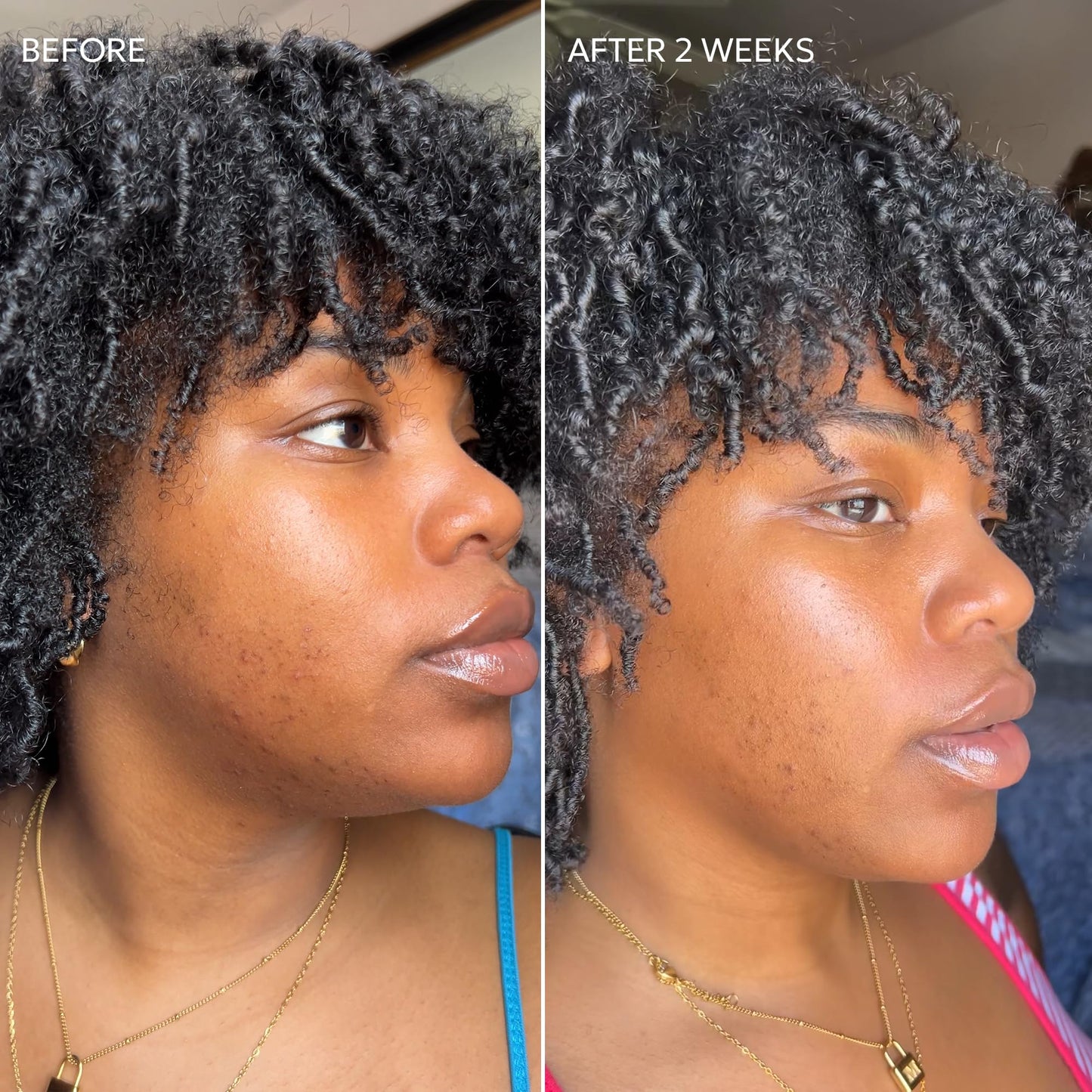 Dermisa Skin Fade Cream with Vitamin C, Licorice and Emblica - Dark Spot Corrector and Face Moisturizer for Sun Spots, Age Spots and Freckles - 1.78