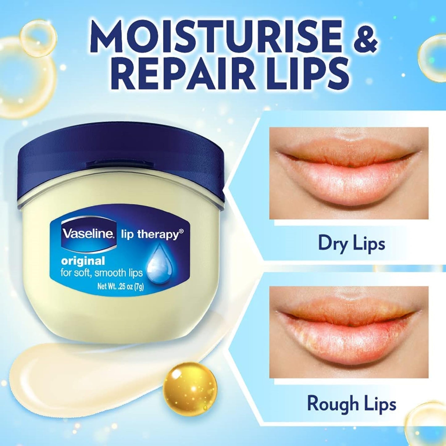 Vaseline Lip Therapy Original, .25 oz (Pack of 9)