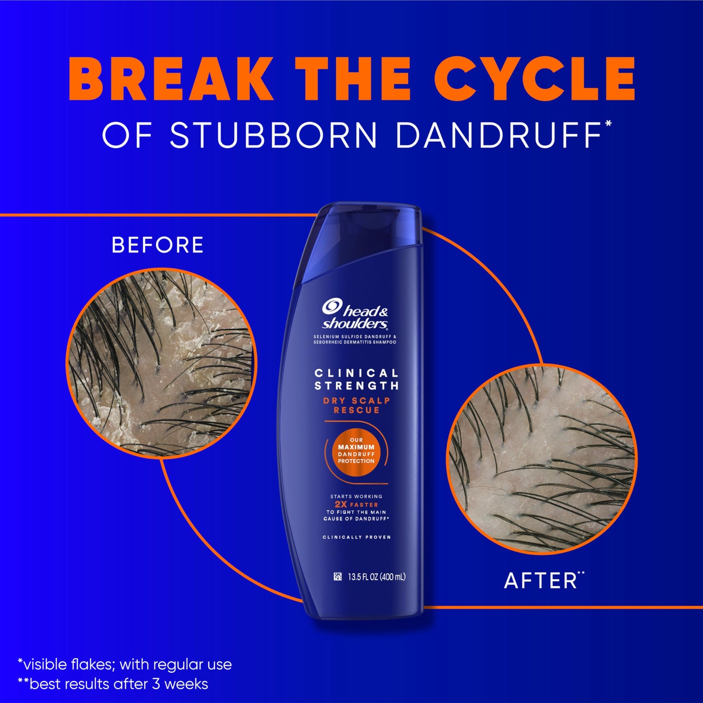 Head & Shoulders Anti-Dandruff Shampoo with 1% Selenium Sulfide, Clinical Strength Dry Scalp Rescue Shampoo Twin Pack, Seborrheic Dermatitis Relief Beauty and Personal Care Head & Shoulders