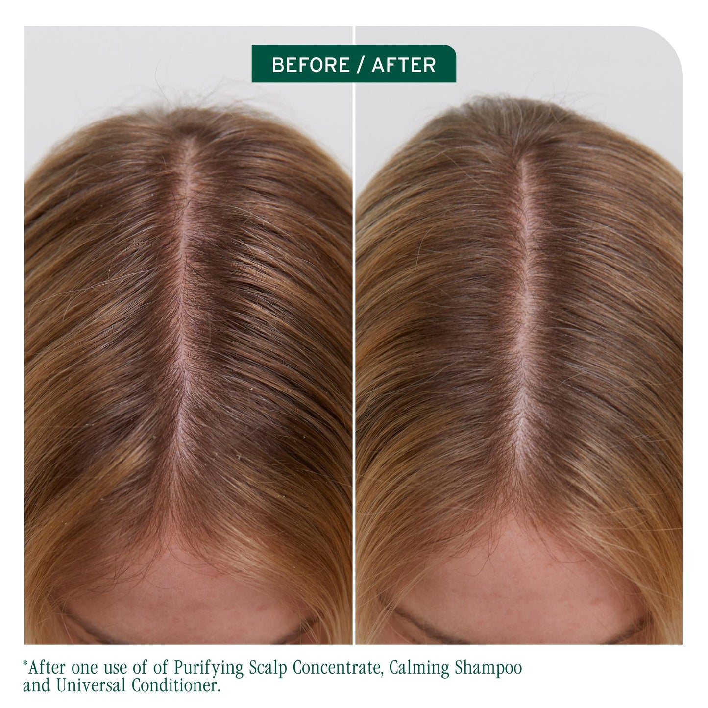Biolage Scalp Sync Universal Conditioner - Nourishing & Hydrating for All Scalp Types, Lightweight Moisturizing & Conditioning, Fermented Tea Blend