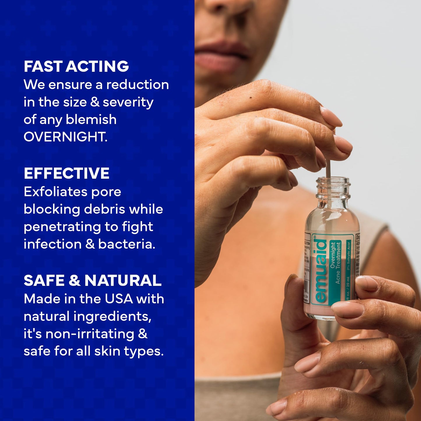 EMUAID Overnight Acne Treatment, Gentle Fast-Acting Solution with Salicylic Acid for Adults and Teens, Clears Stubborn Pimples, Cystic Acne