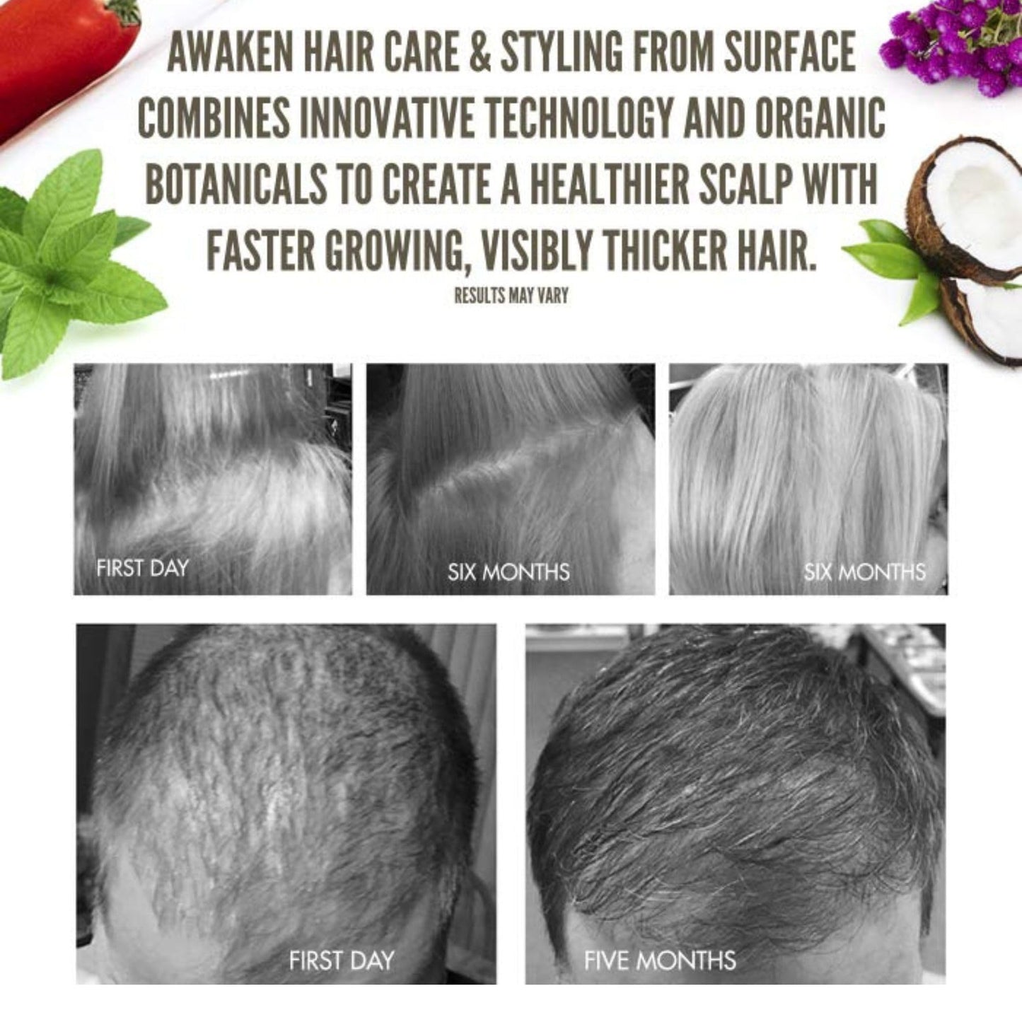 SURFACE Hair Awaken Therapeutic Masque, Scalp And Hair Rejuvenating Mask for Thinning Hair, 6 Oz.