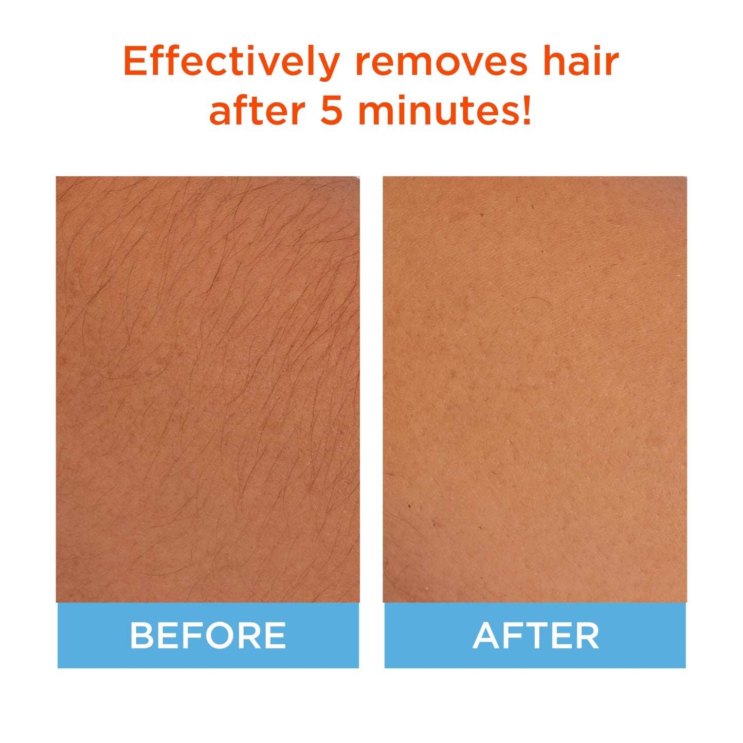 Sally Hansen Hair Remover for Face | Cream Depilatory + Aftercare Lotion | Sweet Almond & Shea Butter Infused Beauty and Personal Care Sally Hansen