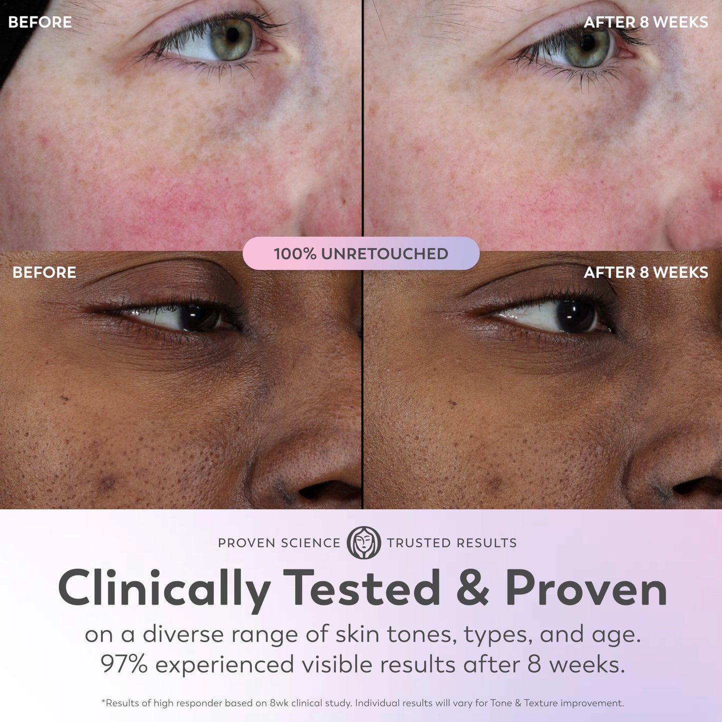 Olay Super Serum Trial Size - Niacinamide, Vitamin C & E, Collagen Peptide, AHA - 5-in-1 Skin Care Benefits - Healthy Glow, Brightening, Hydrating