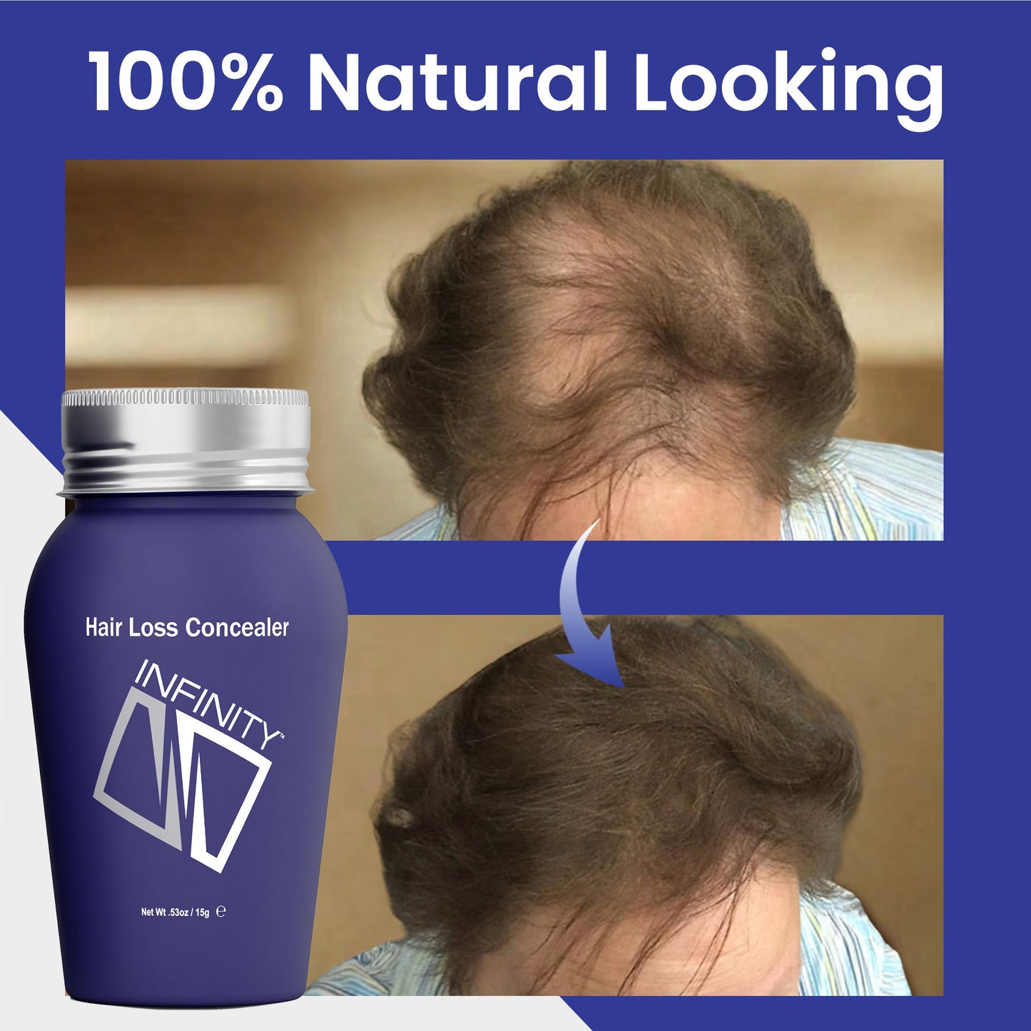 INFINITY Hair Fibers Medium Brown for Thinning Hair for Women & Men - 100% Undetectable Hair Building Fiber Powder - Conceal Hair Loss in 15 Seconds