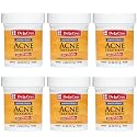 De La Cruz 10% Sulfur Ointment - Cystic Acne Treatment for Face & Body - Daily 10 Min Spot Treatment Mask -Safe & Effective Game Changing Hormonal