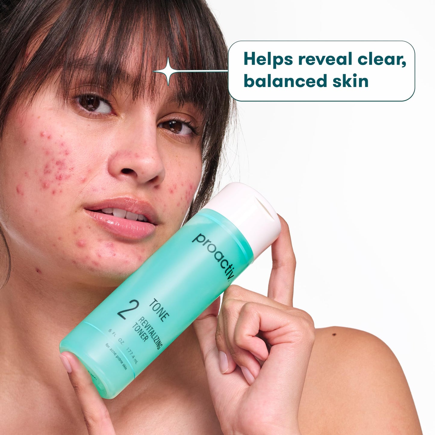 Proactiv Hydrating Facial Toner for Sensitive Skin Alcohol Free Toner for Face Care Pore Tightening Glycolic Acid and Witch Hazel Formula Acne Beauty and Personal Care Proactiv