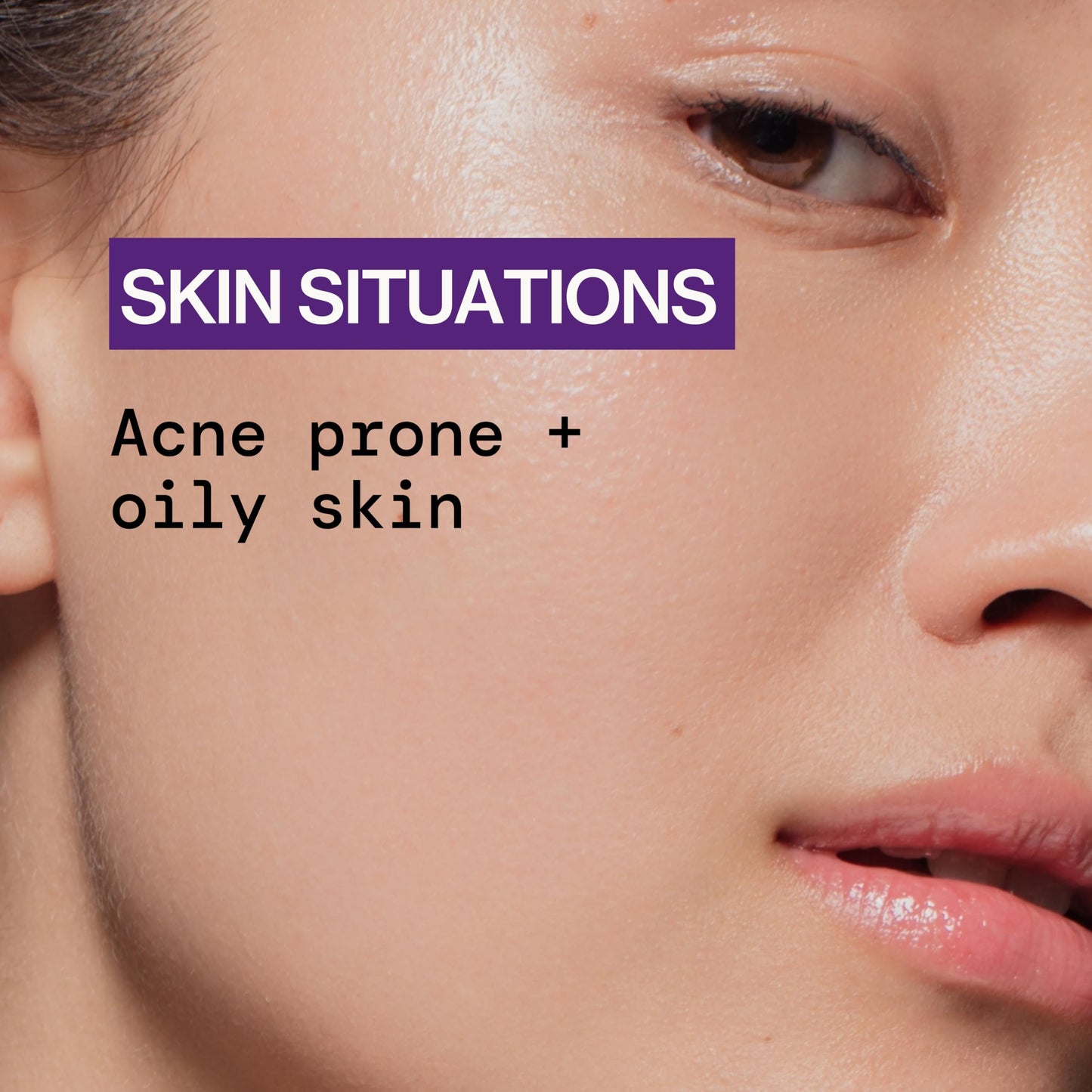 Pacifica Acne Spot Treatment & Pimple Cream - Dry It Out Gel with 2% Salicylic Acid, Witch Hazel, Niacinamide - Dries Blemishes Overnight, Fights