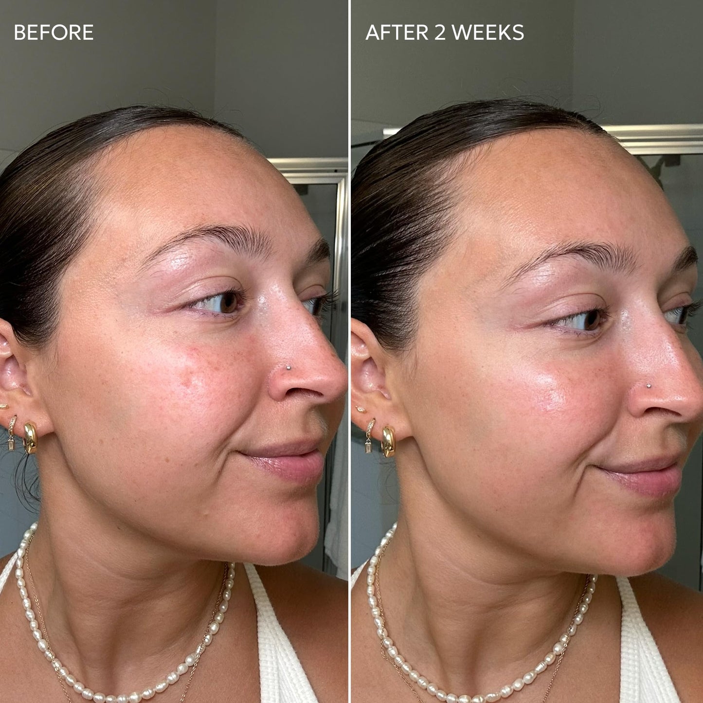 Dermisa Skin Fade Cream with Vitamin C, Licorice and Emblica - Dark Spot Corrector and Face Moisturizer for Sun Spots, Age Spots and Freckles - 1.78