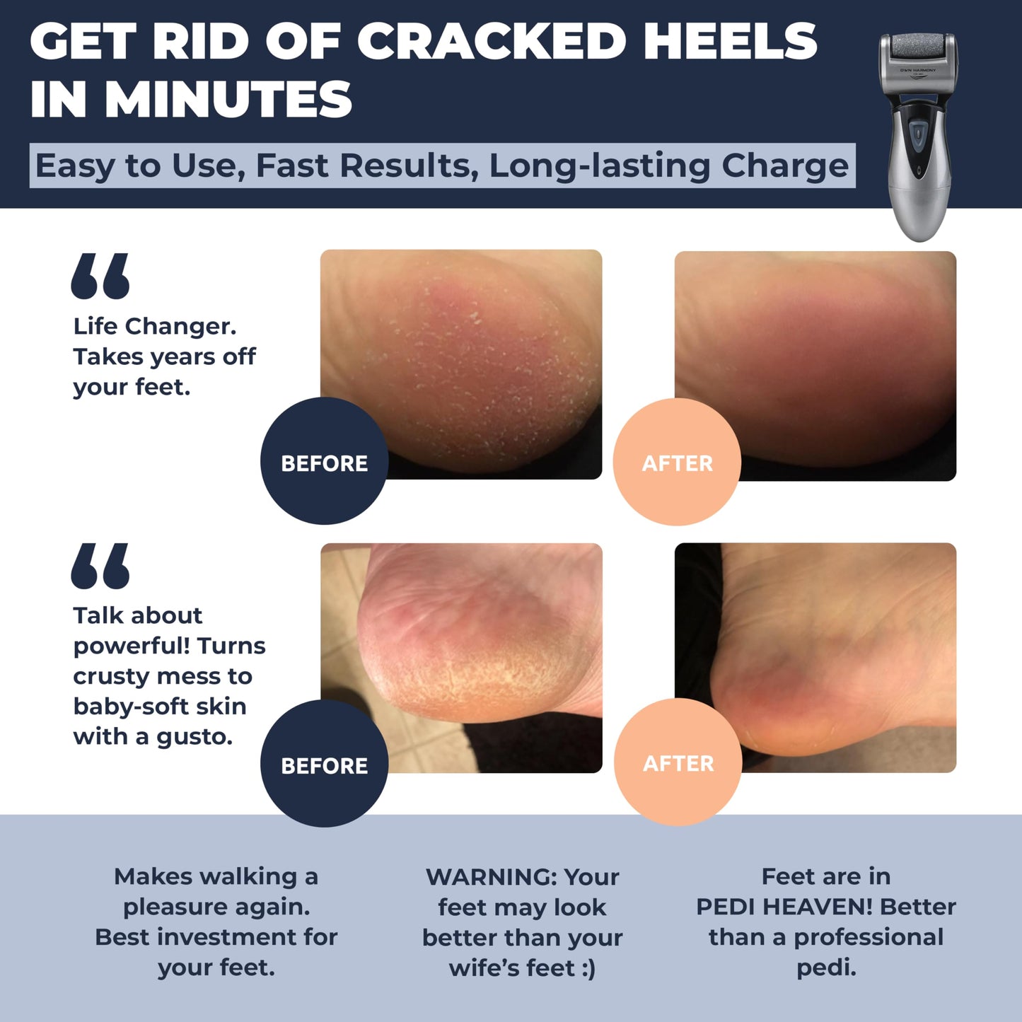 Electric Callus Remover: Rechargeable Electronic Foot File CR900 by Own Harmony(Tested Most Powerful) Best Pedicure Tools w 3 Rollers Professional