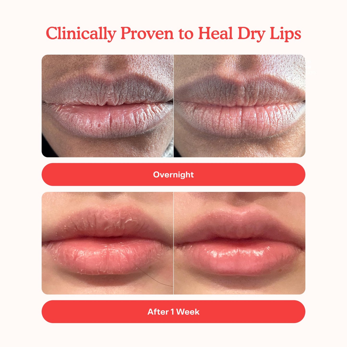 Tower 28 LipSoftie Tinted Lip Balm Treatment - Hydrating Glossy Balm + Overnight Lip Mask with Jojoba Oil + Shea Butter - Sweet, Cushiony Formula