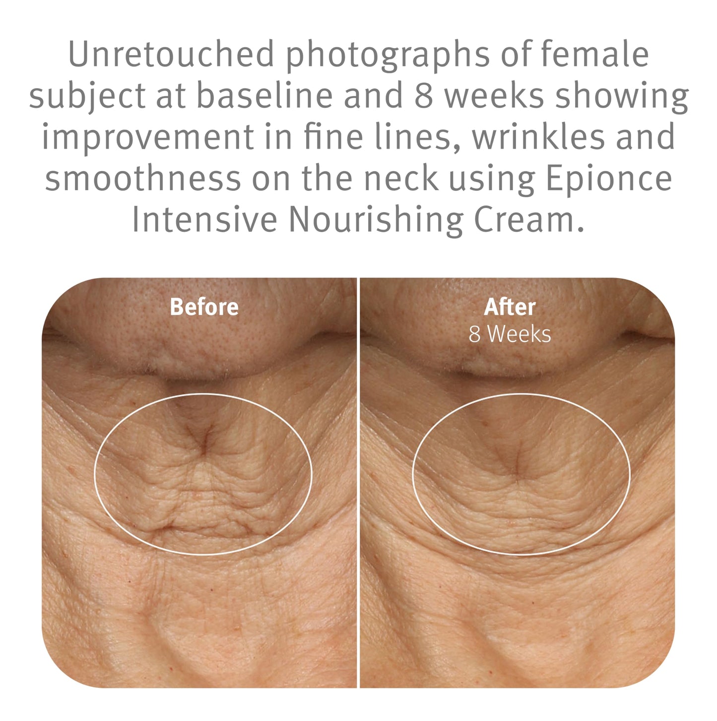 Epionce Intensive Nourishing Cream - Rich Anti-Aging Moisturizer for Face, Neck & Décolletage | Ceramides, Glycerin & Squalene | Targets Fine Lines