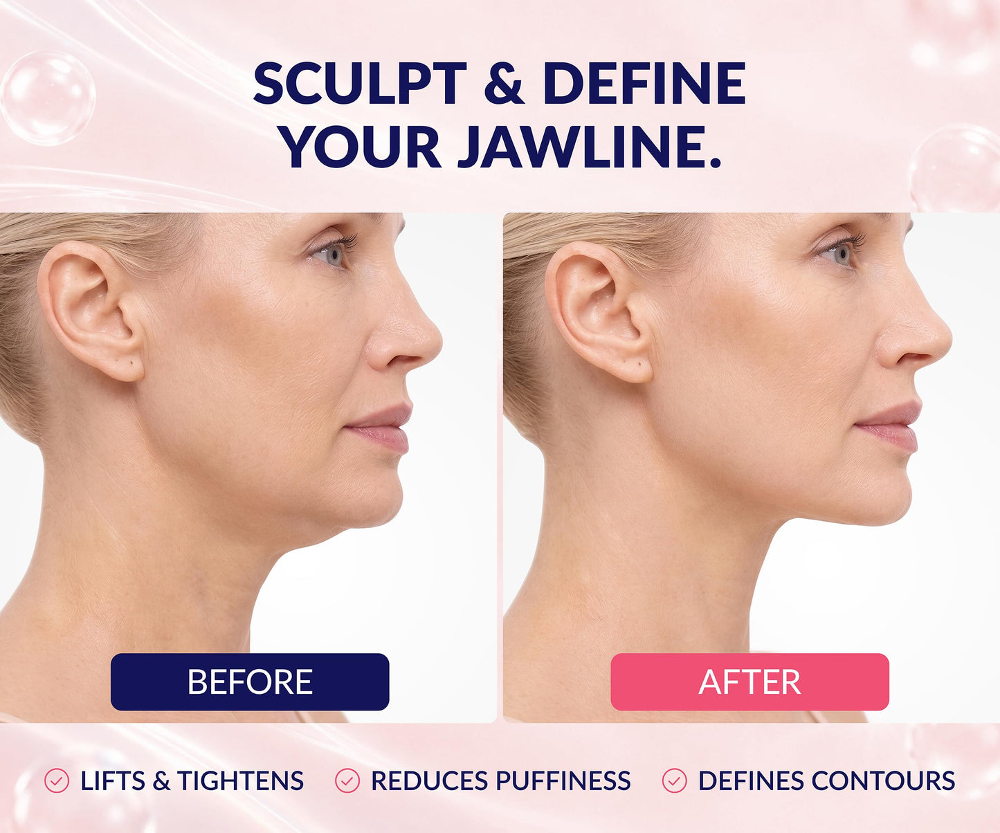 Stylia V Line Lifting Collagen Mask - Lift, Firm & Contour Jawline - Tightening Double Chin Strap with Hyaluronic Acid & Aloe - Neck Tightening Beauty and Personal Care Stylia