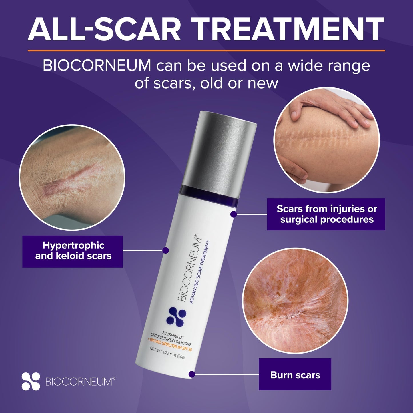 Biocorneum Silicone Scar Gel with Silishield®, SPF 30 Scar Cream, 20g Beauty and Personal Care BIOCORNEUM
