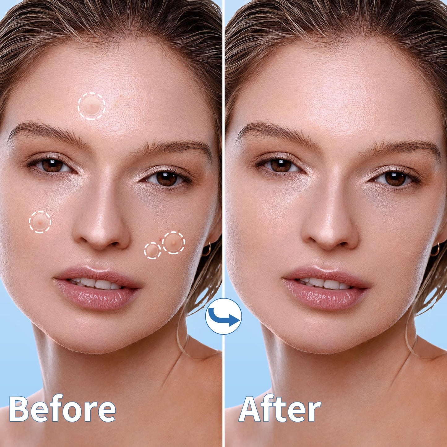 Daolyo Pimple Patches for Face, 4 Size 300 Counts Acne Patches, Hydrocolloid Patches for Covering Zits and Blemishes, Spot Stickers with Salicylic