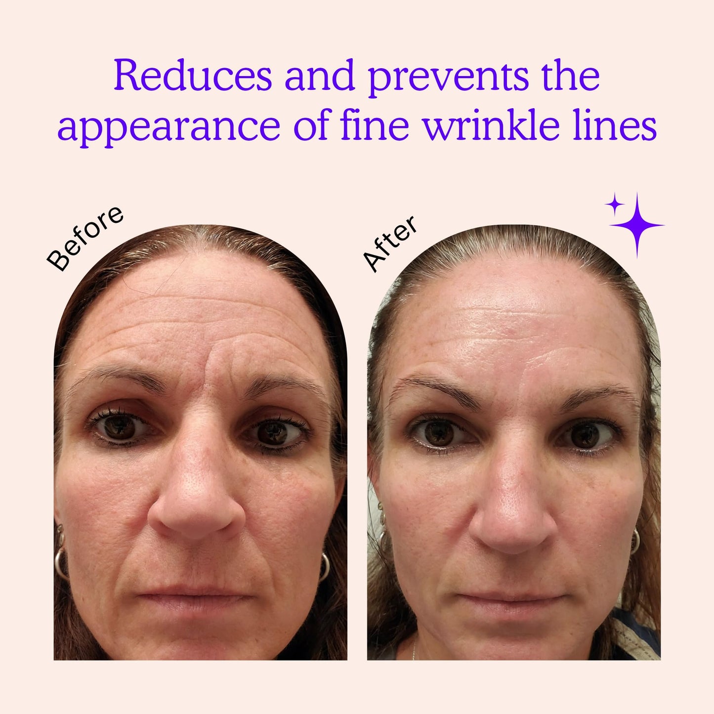 BLUMBODY Face, Forehead Wrinkle Patches - Anti Wrinkle Facial Patches to Smooth Eye, Mouth, Forehead Wrinkles - Non-Silicone Face Tape for Fine