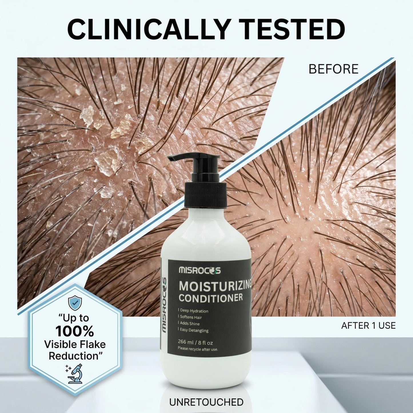 MISROCOS Moisturizing Conditioner & Anti-Dandruff Shampoo - Hair Care Essentials for Professional Scalp Care, Deep Hydration, Shine, Flake Control