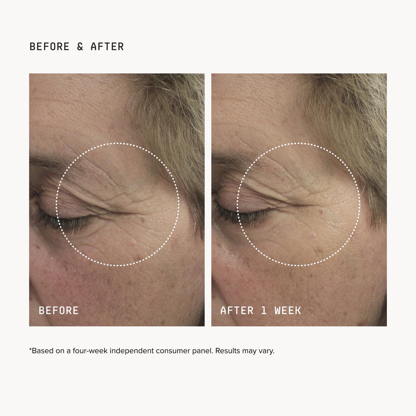 DRMTLGY Brightening Eye Masks - Biodegradable Hydrogel Under Eye Patches with Caffeine, Peptides, Hyaluronic Acid & Niacinamide - Depuff, Hydrate Beauty and Personal Care DRMTLGY