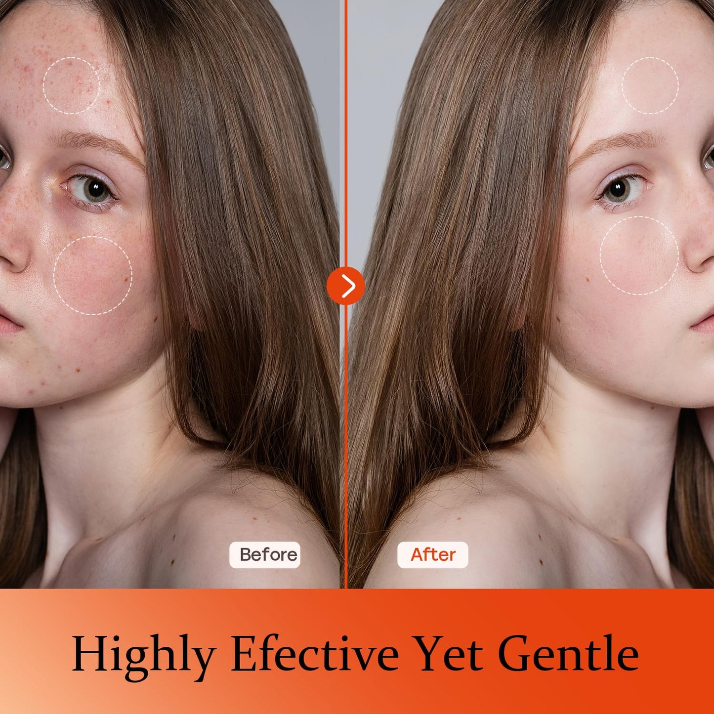 Vitamin C Serum For Face-Anti Aging & Wrinkle Facial Serum With Vitamin C,Sodium Hyaluronate,Vitamin E And More,Skin Brightening Serum For Dark