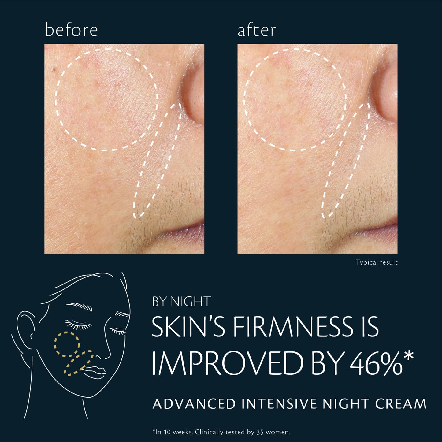 Advanced Intensive Night Cream (Refill)