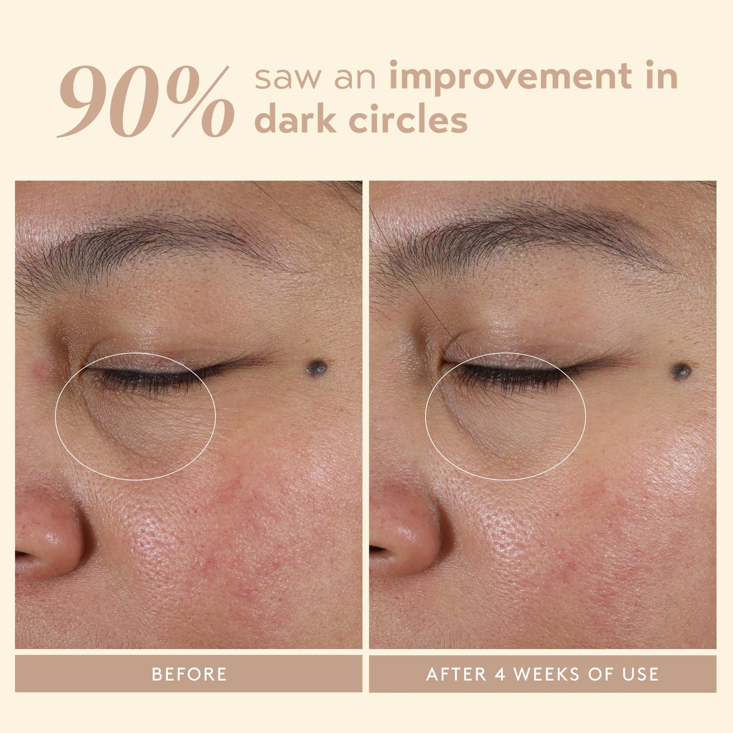 SHANI DARDEN Intensive Eye Renewal Cream, Hydrating Under Eye Cream for Dark Circles, Fine Lines, Wrinkles & Crows Feet with Niacinamide, Shea Butter