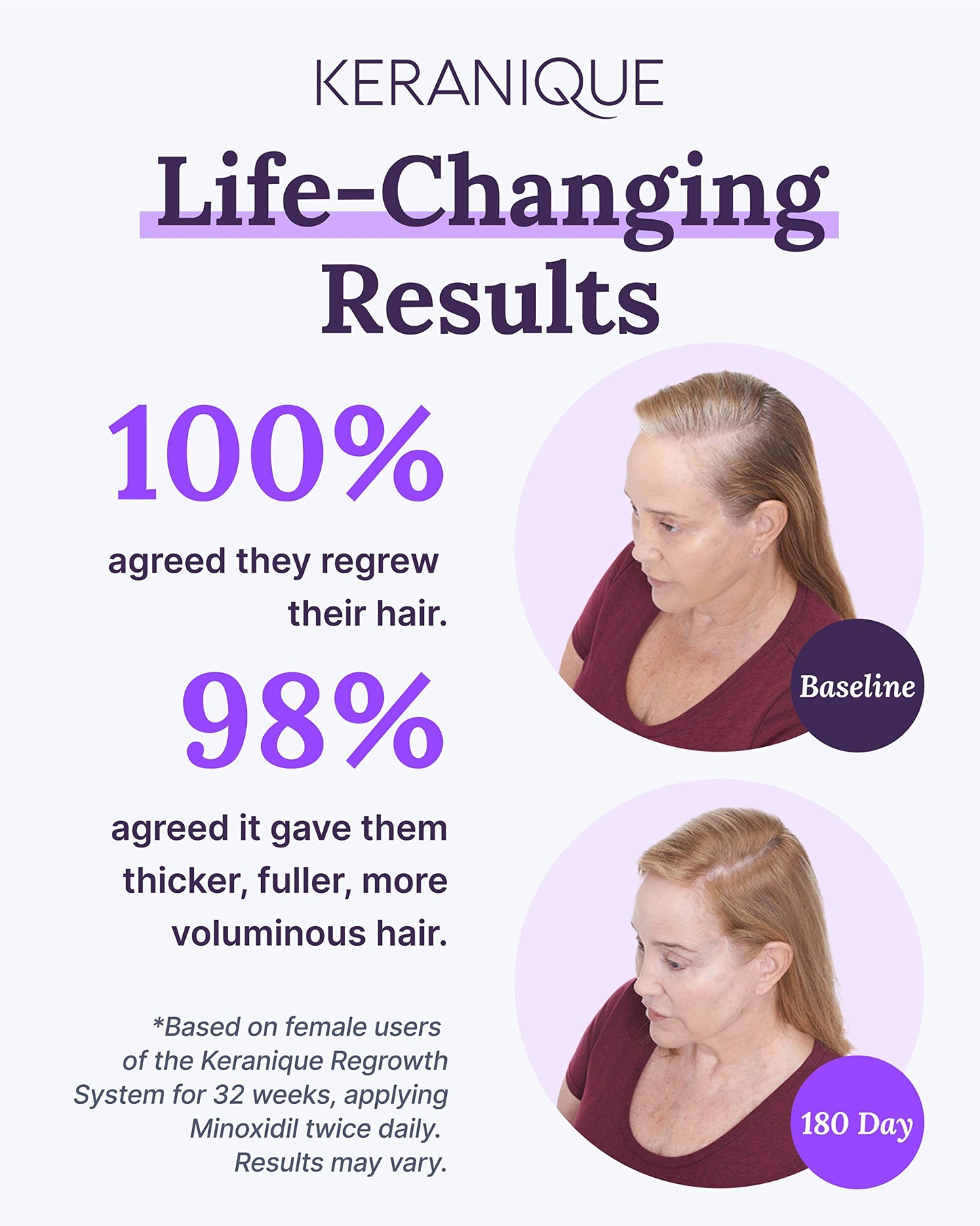 Keranique Hair Regrowth Treatment for Women - 2% Minoxidil for Hair Growth & Thickening - Topical Solution Scalp Treatment for Hair Loss & Thinning w Beauty and Personal Care Keranique