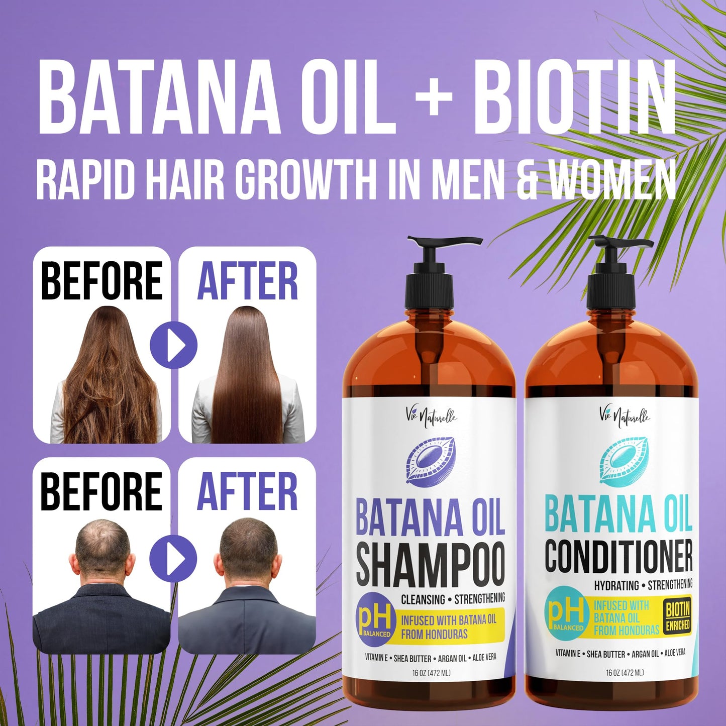 Vie Naturelle Hair Growth Shampoo and Conditioner Set - Batana Oil for Thinning Hair Men Women - 16 oz Each