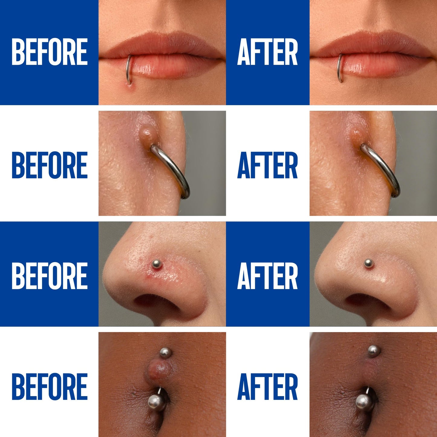 BodyJ4You Piercing Aftercare Spray - Saline Solution for Piercings Wound Wash Sterile Saline - Keloid Bump Removal Ear Nose Septum Belly Button Beauty and Personal Care BodyJ4You