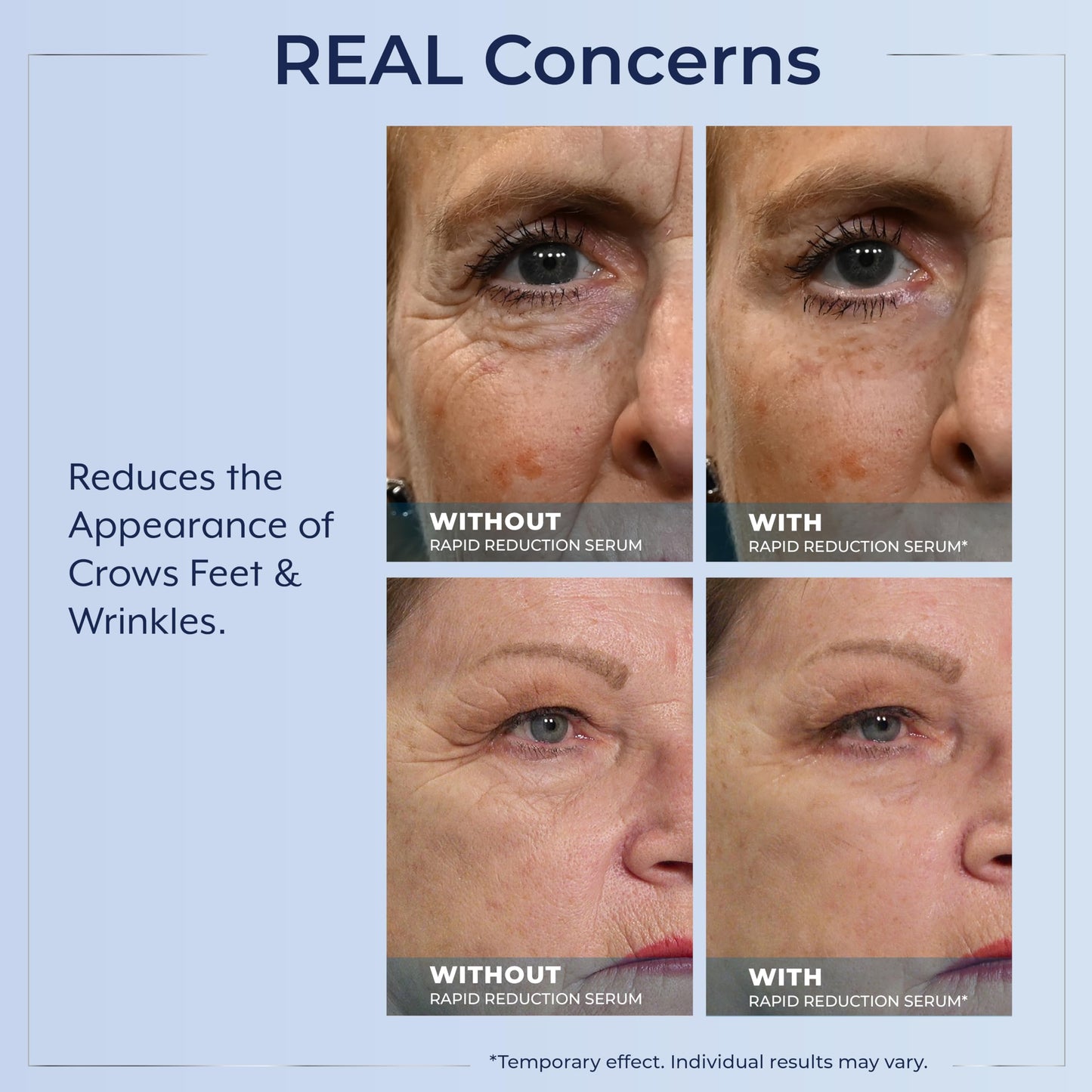 Plexaderm Rapid Reduction Eye Serum - Visibly Reduces Under-Eye Bags, Wrinkles, Dark Circles, Fine Lines & Crow's Feet Instantly, Anti Aging Wrinkle