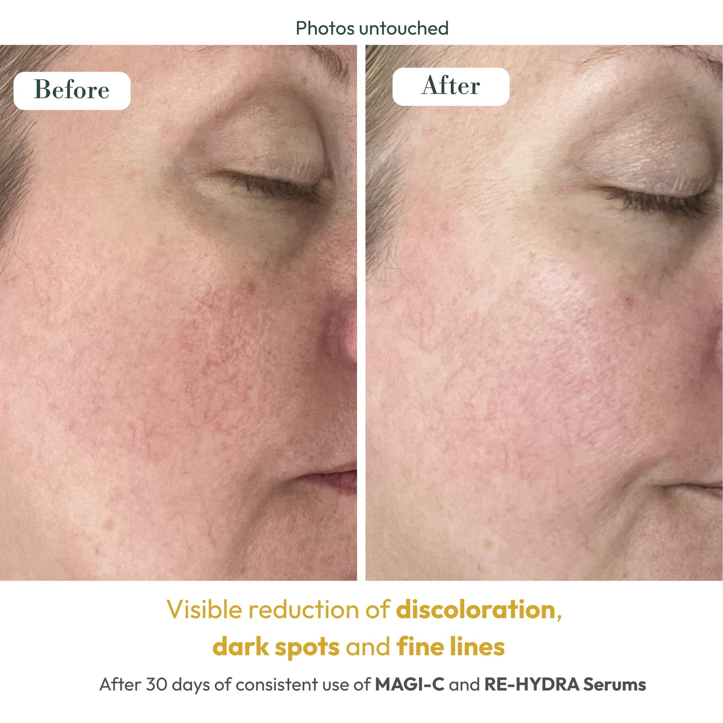 RECOLLAGEN® III RE-HYDRA SERUM Beauty & Personal Care ELASCO
