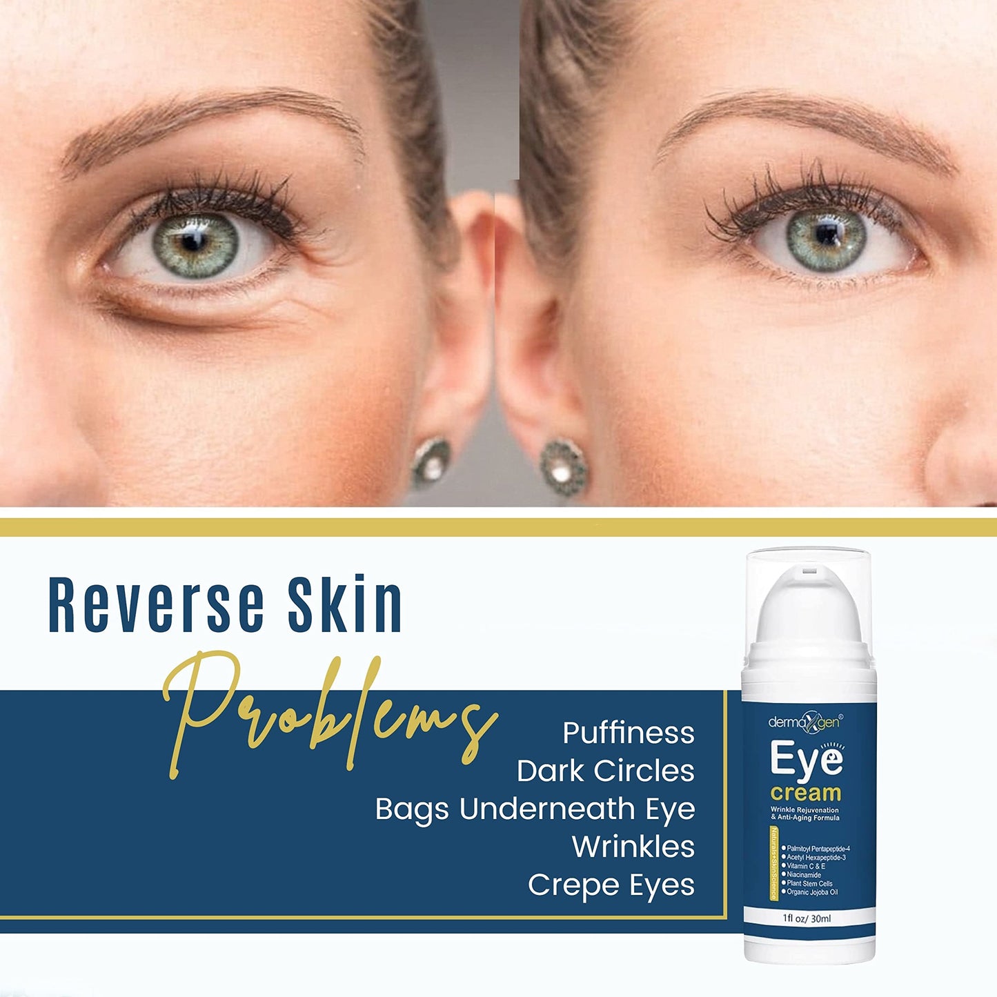 DERMAXGEN - Eye Cream Treatment for Dark Circles, Under Eyes to Smooth Fine Lines, Eliminate Dark Circles, and eye Bags, Moisturizing Eye Gel