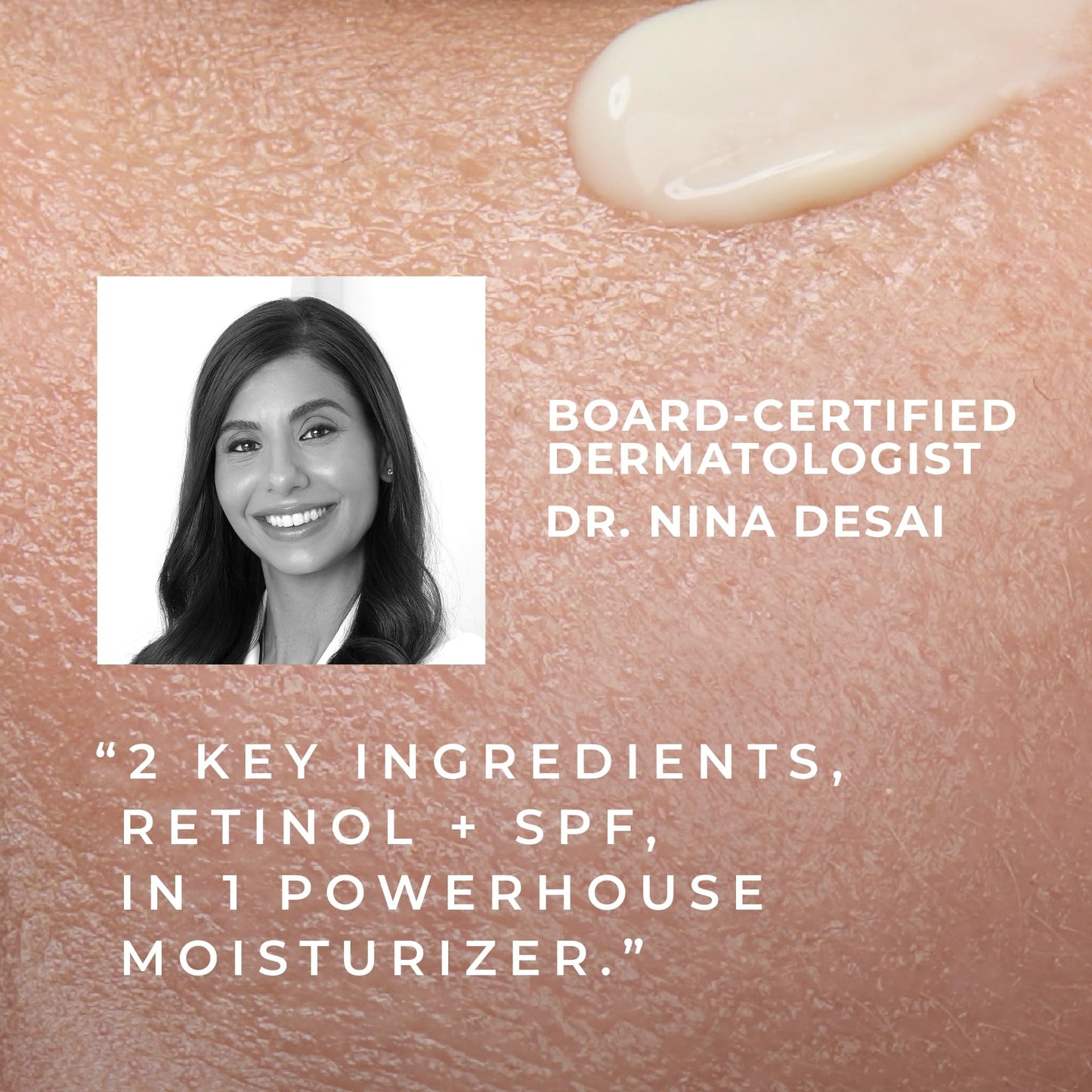 RoC Retinol Correxion Deep Wrinkle Daily Moisturizer SPF 30 – Anti-Aging Face Cream for Fine Lines, Dark Spots & Post-Acne Scars, 1 oz