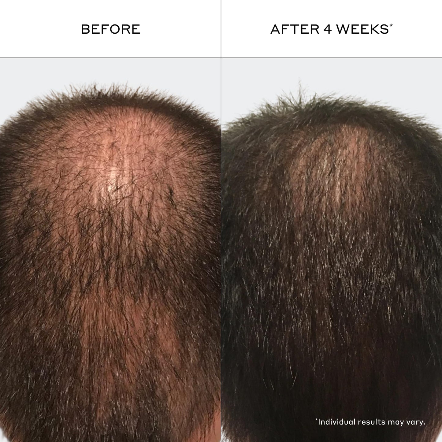 Zenagen Revolve Thickening Shampoo & Conditioner Bundle for Men (6.75 oz Each) - For Fine & Thinning Hair, Supports Fuller, Thicker-Looking Hair