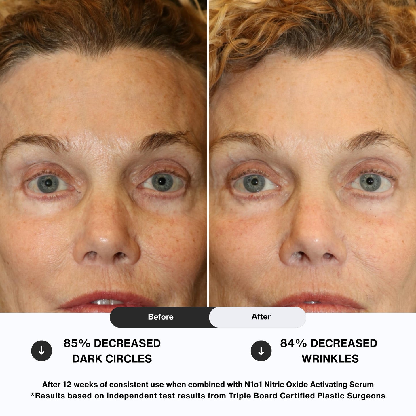 N1O1 Age-Defiance Eye Cream - Day & Night Moisturizer with Nitric Oxide, Hyaluronic Acid, Complex Peptides, Ceramides - Hydrating Eye Cream for Dark