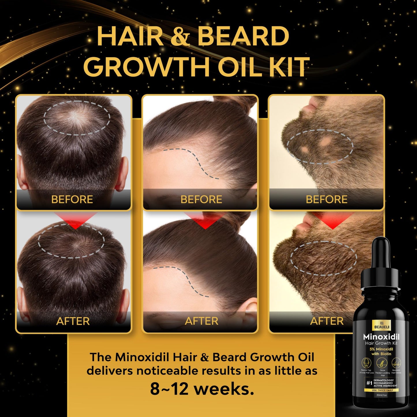 Beaueli Minoxidil Beard Growth Kit For Men and Women, Hair Loss and Hair Regrowth Treatments, Minoxidil 5%, Black Beauty and Personal Care beaueli