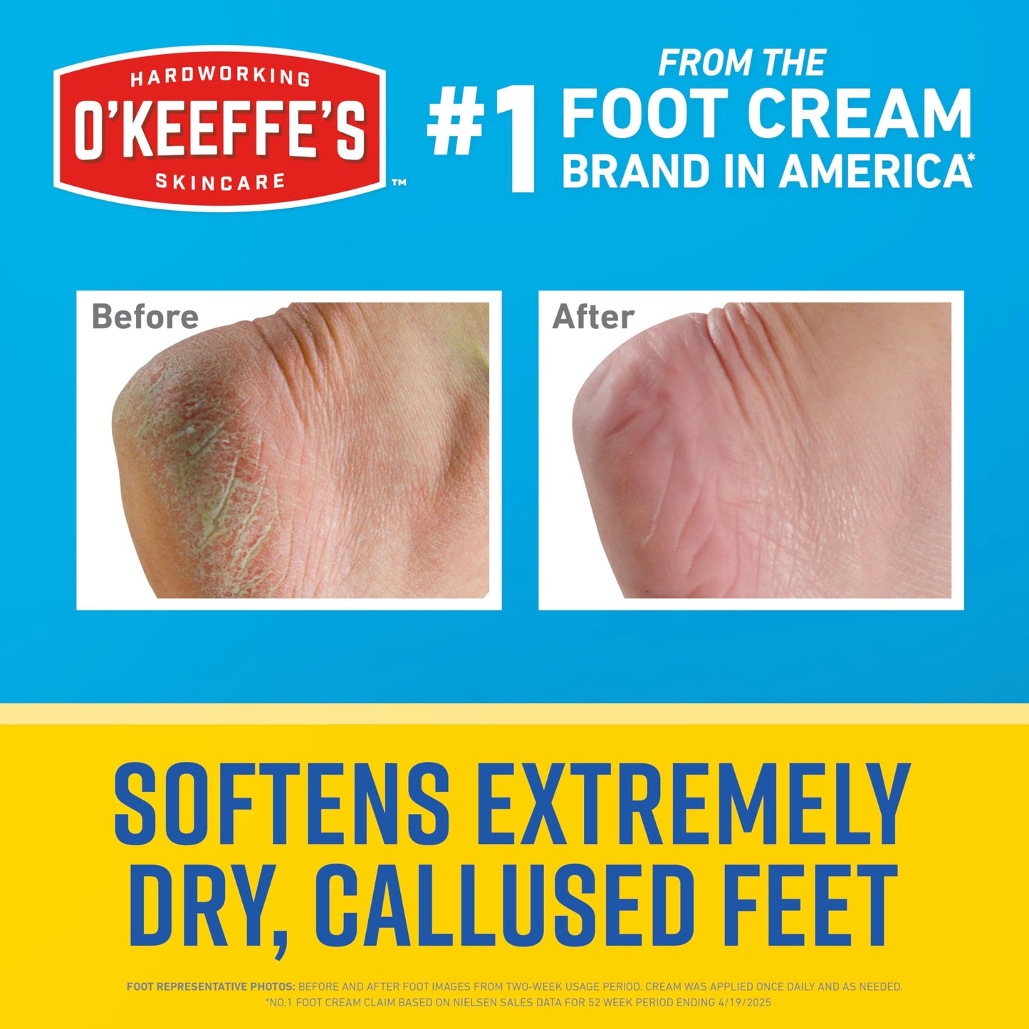 O'Keeffe's for Healthy Feet Intense Renewal Cream with Urea & Alpha Hydroxy Acid - 3 oz Tube (1 Pack) - Chemically Exfoliates and Softens Extremely Beauty & Personal Care O'Keeffe's