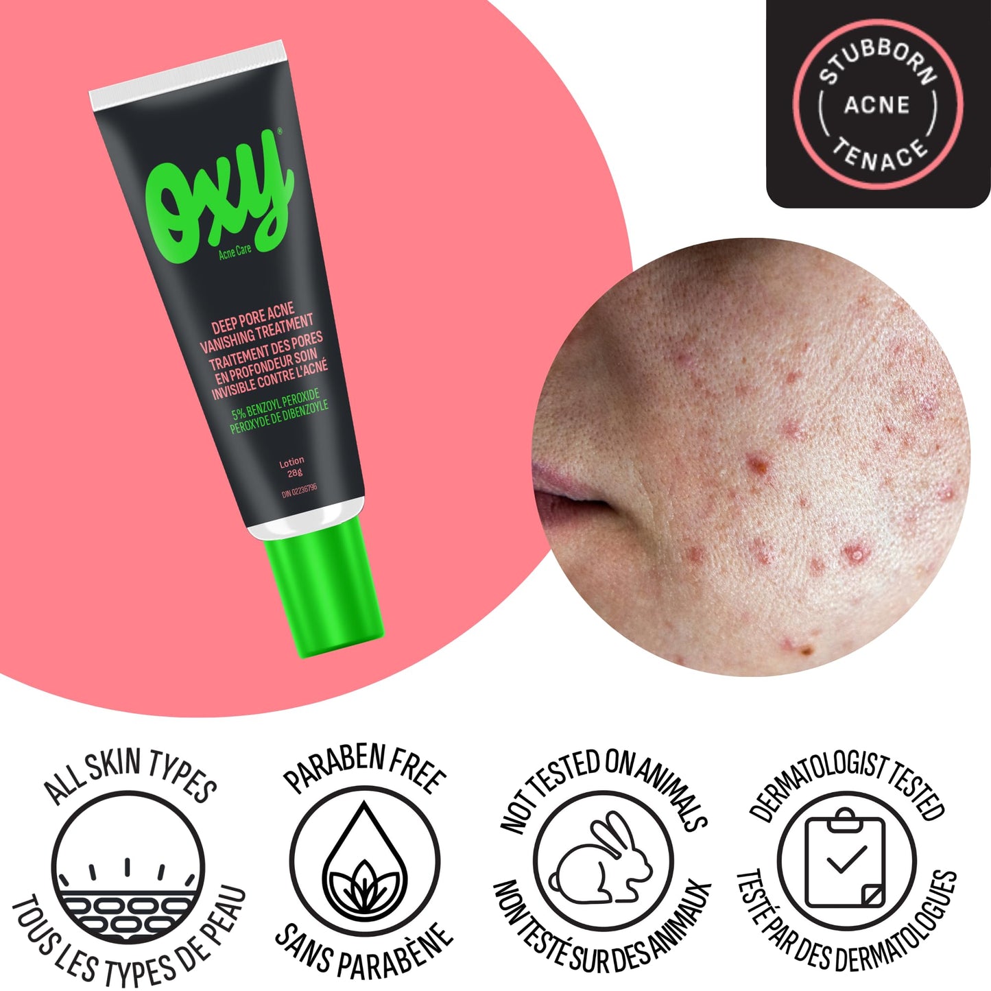 Oxy Acne Vanishing Treatment 0.10-Inches