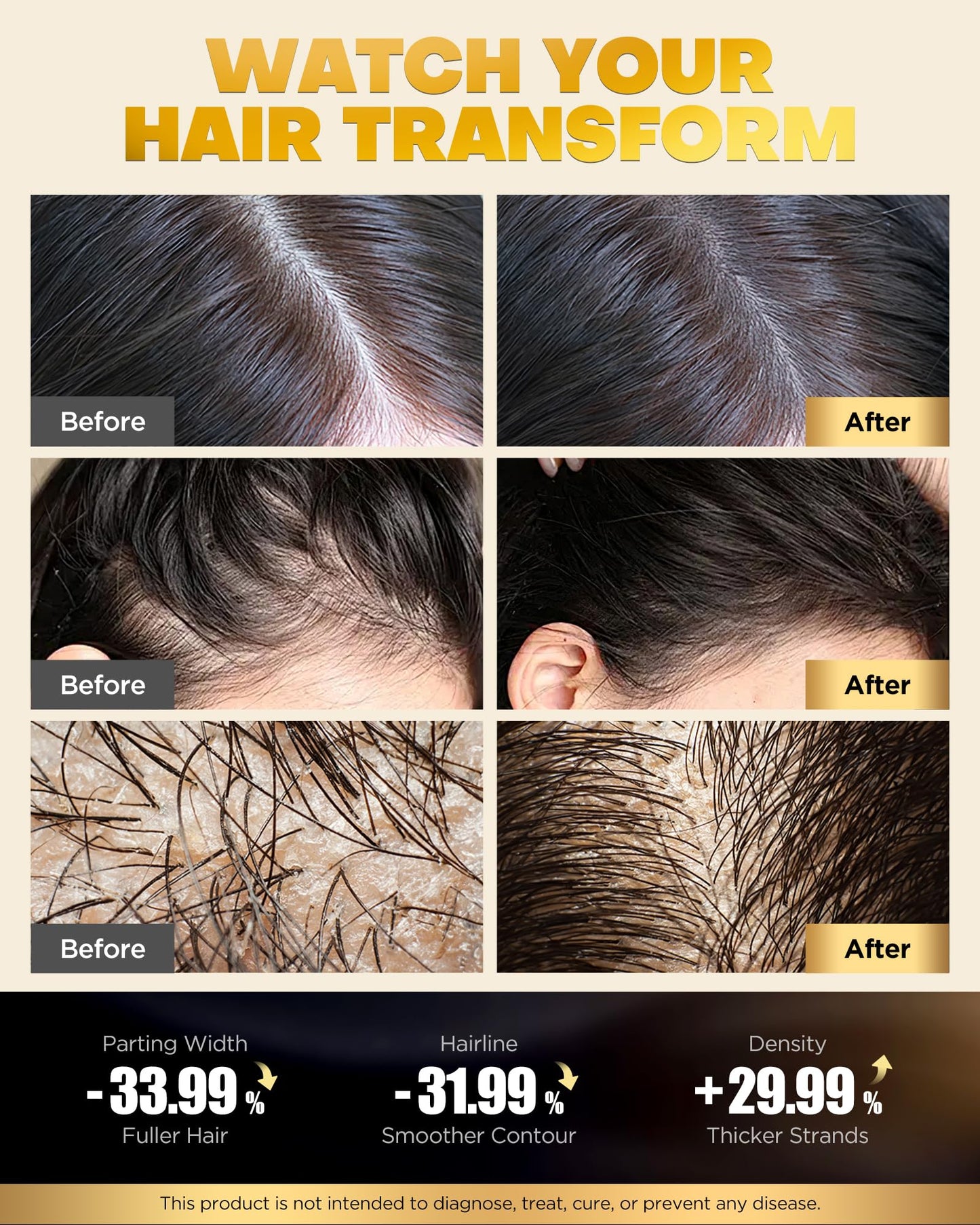 COOLKESI Tripeptide-Infused Biotin Hair Growth Shampoo and Conditioner Set, Onion Anti-Loss Volumizing Moisturizing Treatment for Soft Shine Hair