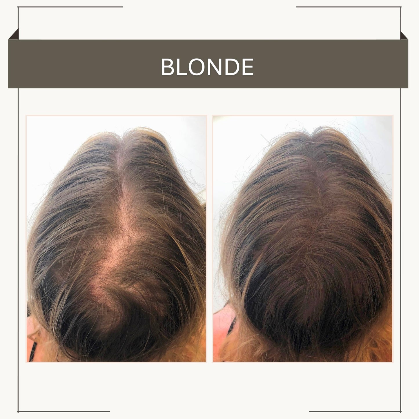 Joan Rivers Great Hair Day Root Touch Up Powder - Fill-in Powder for Thicker, Fuller Looking Hair (Blonde)