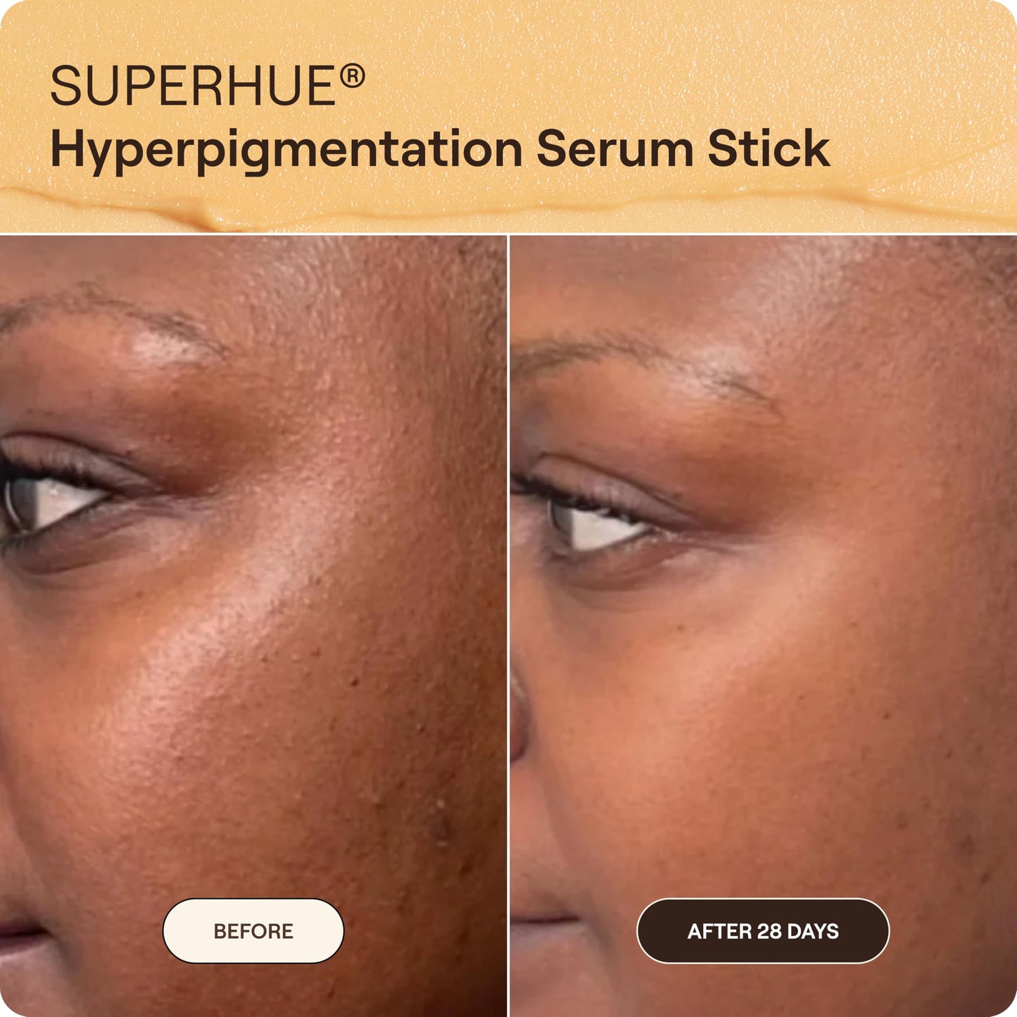 Live Tinted Superhue Hyperpigmentation Serum Stick - Balm-to-Serum Stick For Face & Body - Skin Care with Niacinamide & Vitamin C, Facial Serum Stick